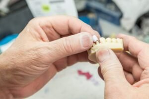 Dental 3d printing market growth: innovations and predictions for 2024 1